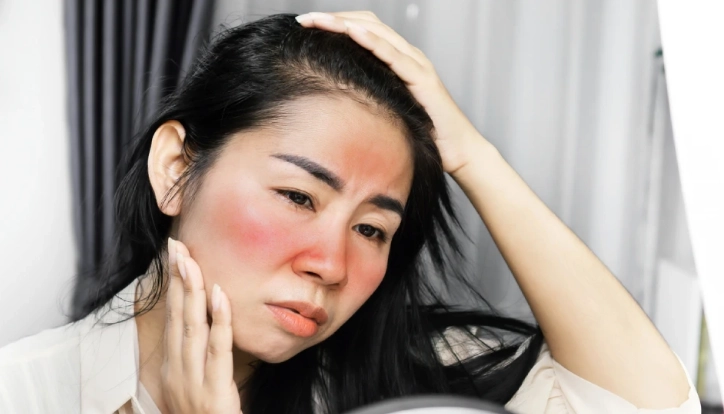 lupus symptoms in women