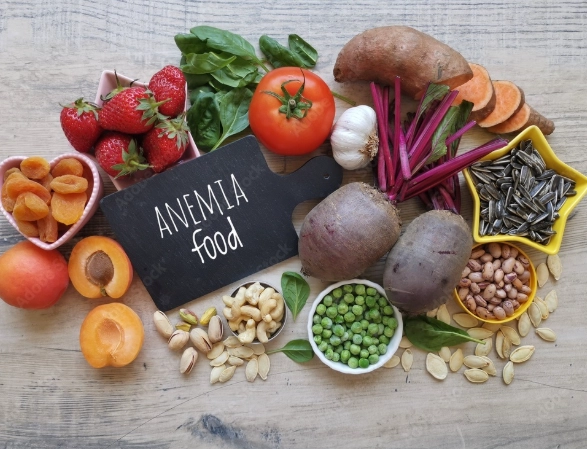 how to treat anemia with food