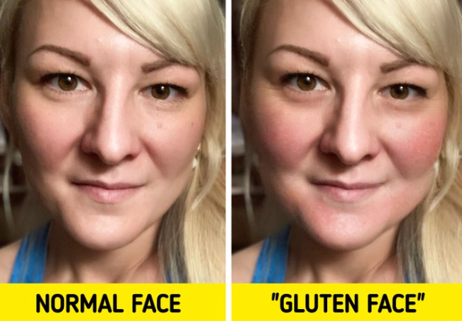 no gluten side effects