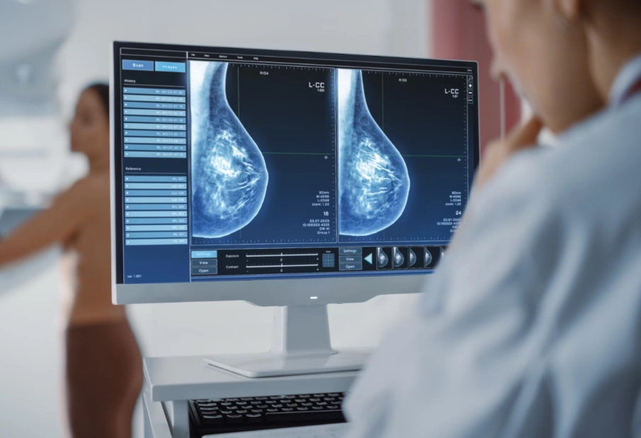 mammogram screening benefits