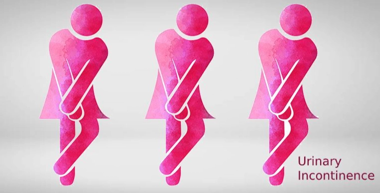 bladder control problems women