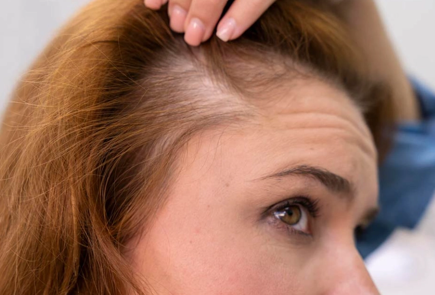 women's hair loss treatment