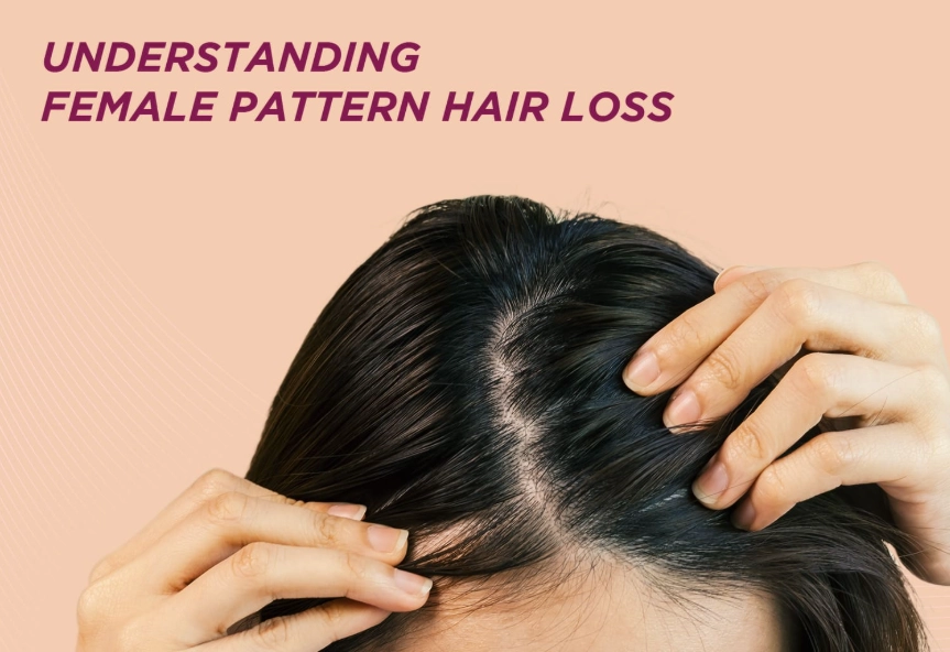 women's hair loss treatment