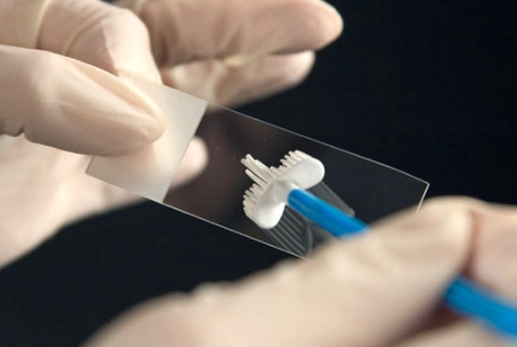 abnormal pap smear results