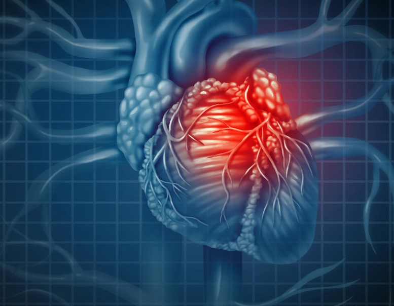 heart disease risk factors women