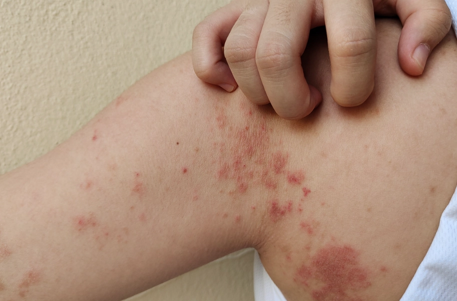 women autoimmune disorders