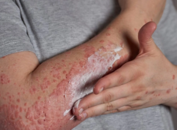 women's health prevention