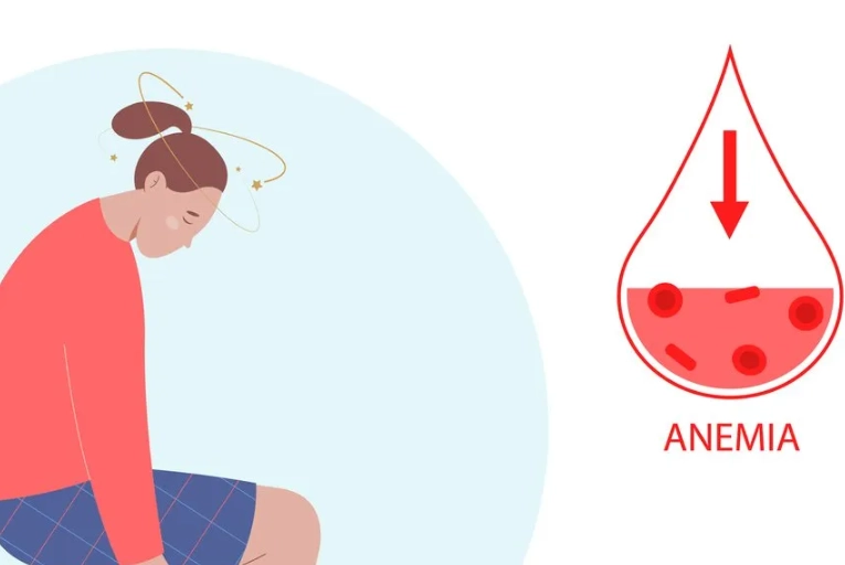 iron deficiency symptoms