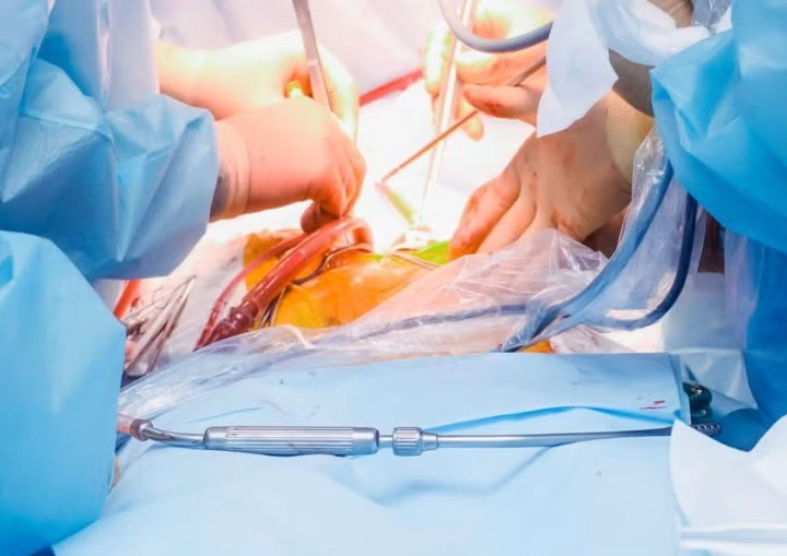 endometriosis laparoscopy endometriosis laparoscopy