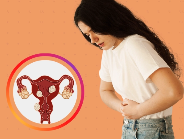 Endometriosis symptoms