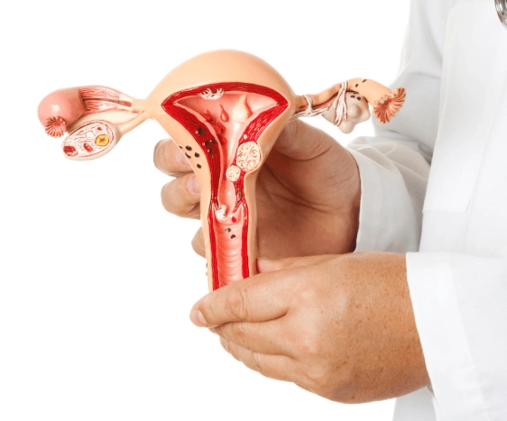 endometriosis risk factors endometriosis risk factors