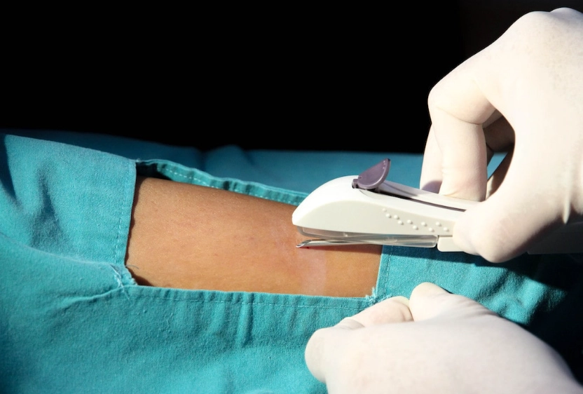 Birth control implant