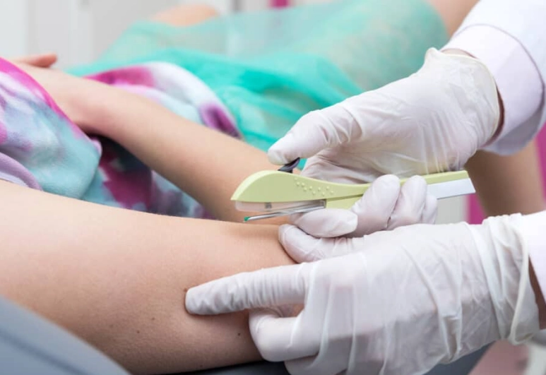 contraceptive implant contraceptive implant