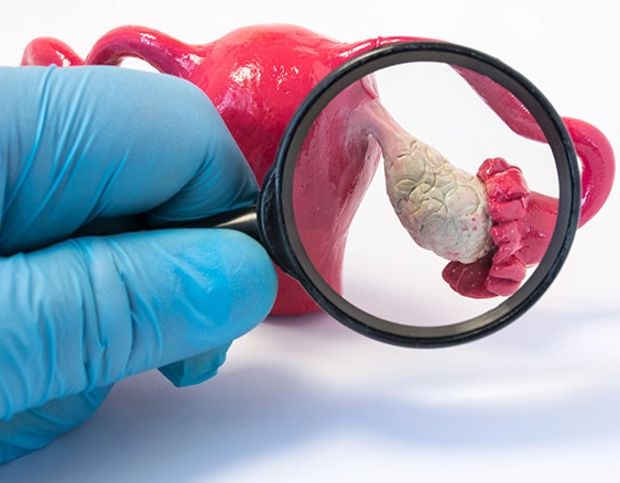 premature ovarian failure