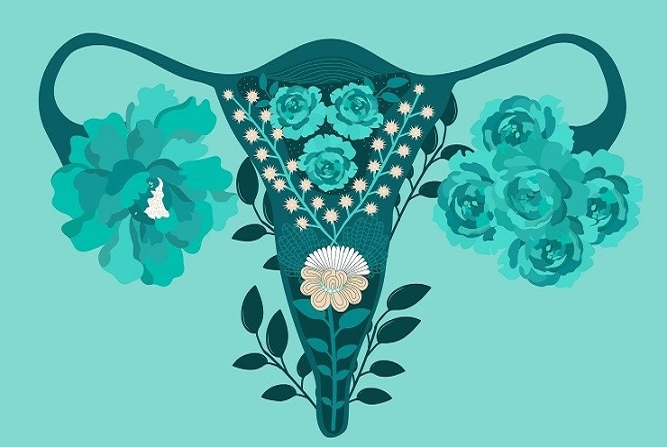 reverse PCOS naturally