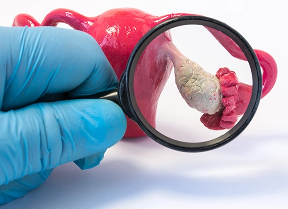 PCOS symptoms checklist