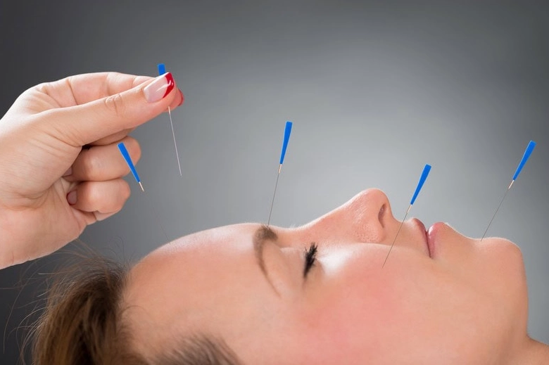women's health acupuncture women's health acupuncture