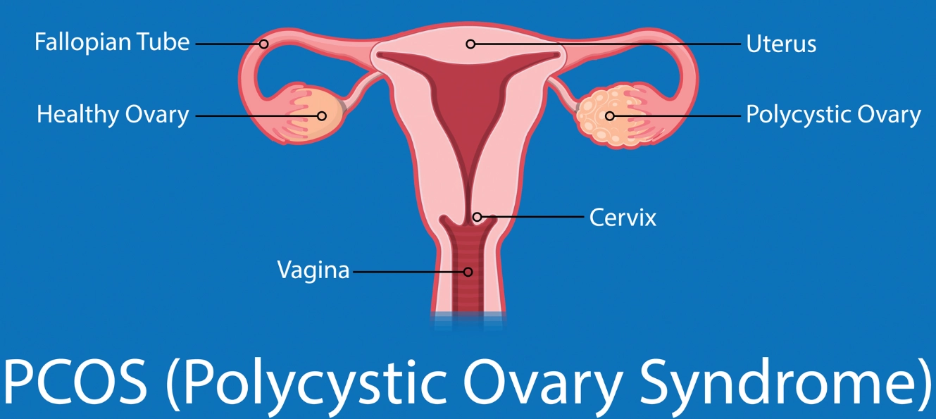 abdominal bloating women abdominal bloating women