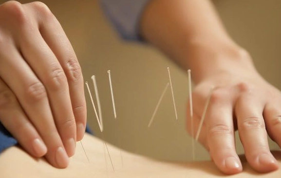 acupuncture for women