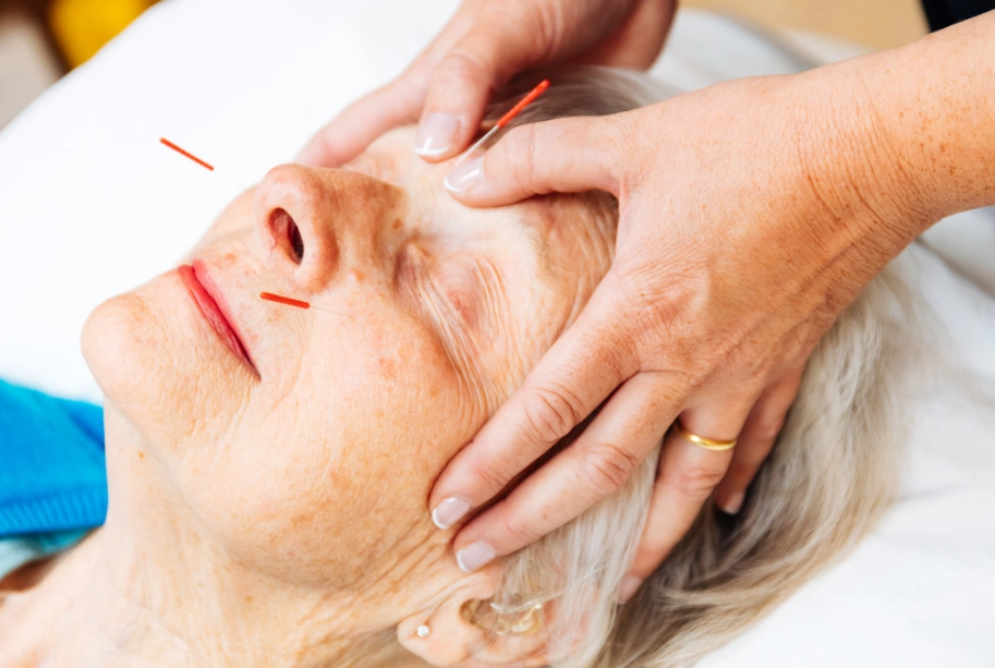 acupuncture for hormonal balance acupuncture for hormonal balance