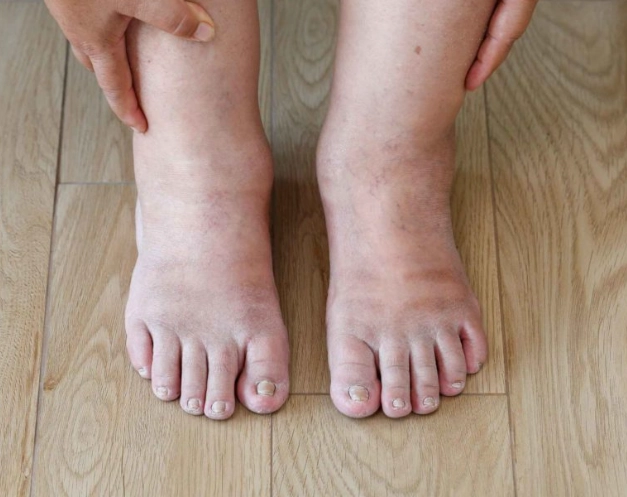 female diabetes symptoms female diabetes symptoms