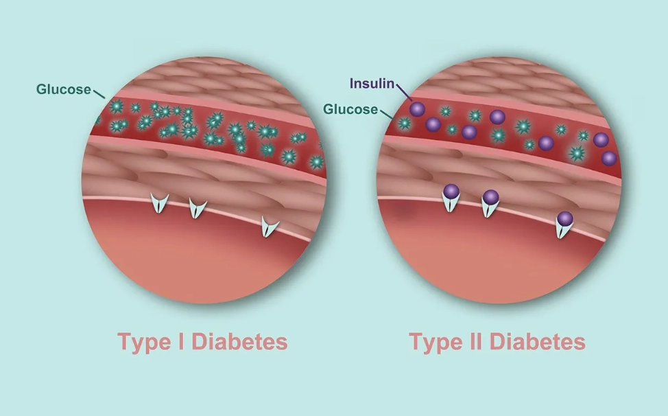 how to test for diabetes