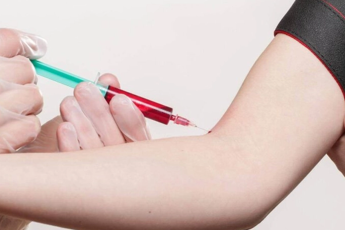 symptoms of diabetes in women symptoms of diabetes in women