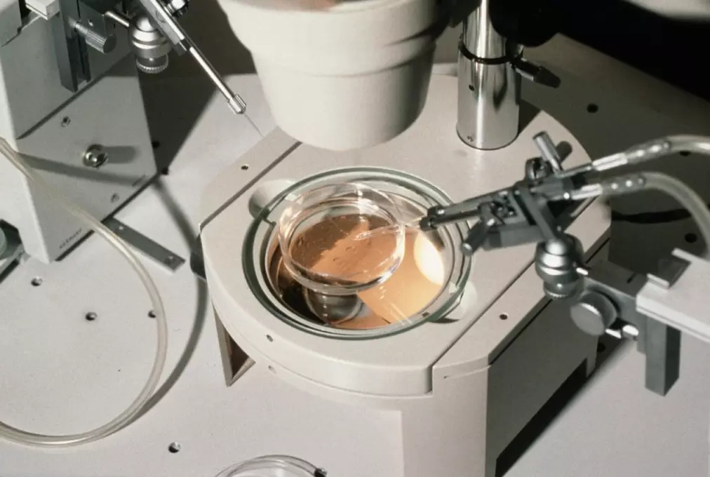 IVF add-ons IVF add-ons