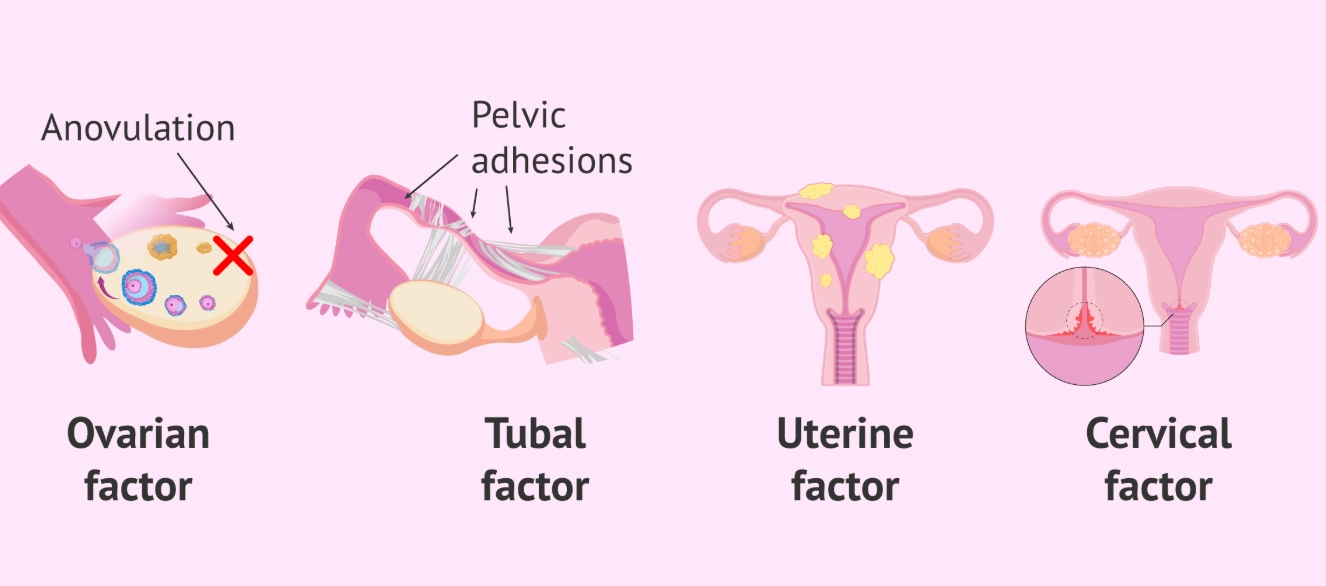 improving female fertility naturally