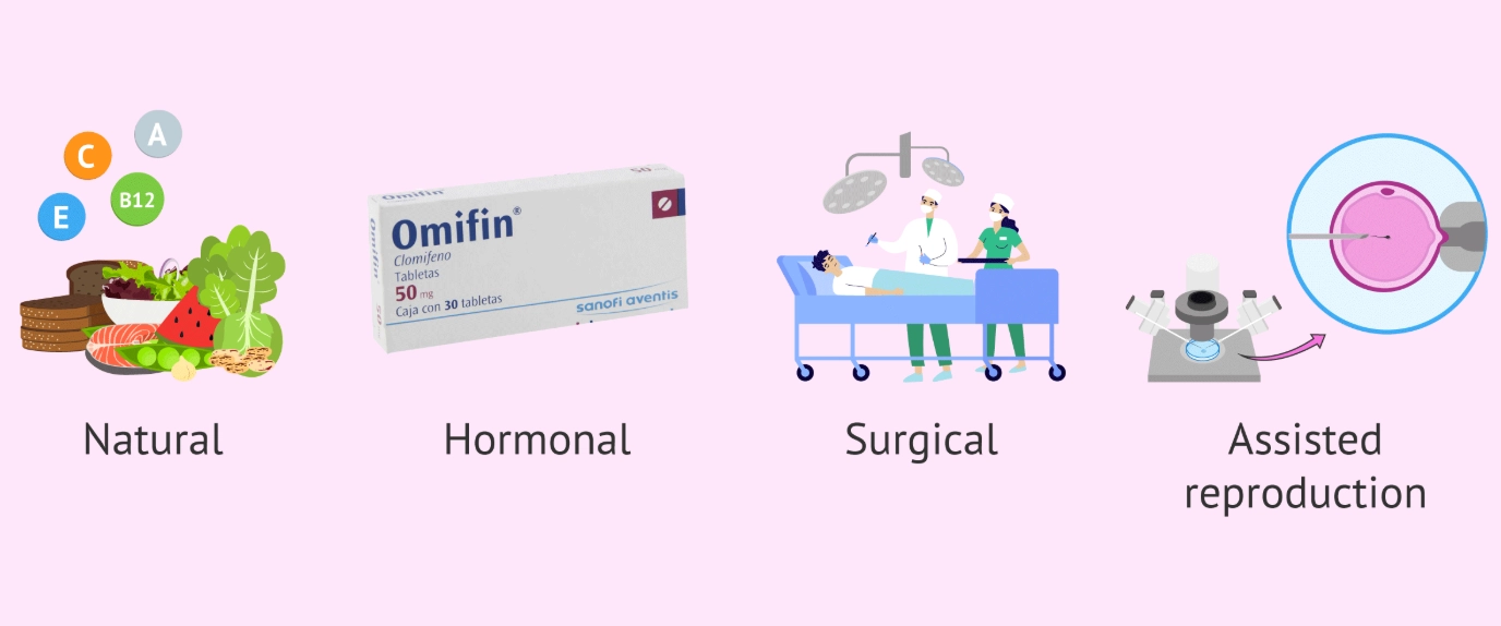 infertility treatment options