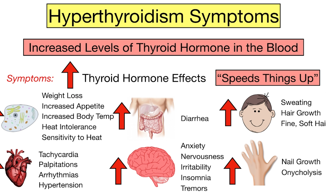 thyroid symptoms in women