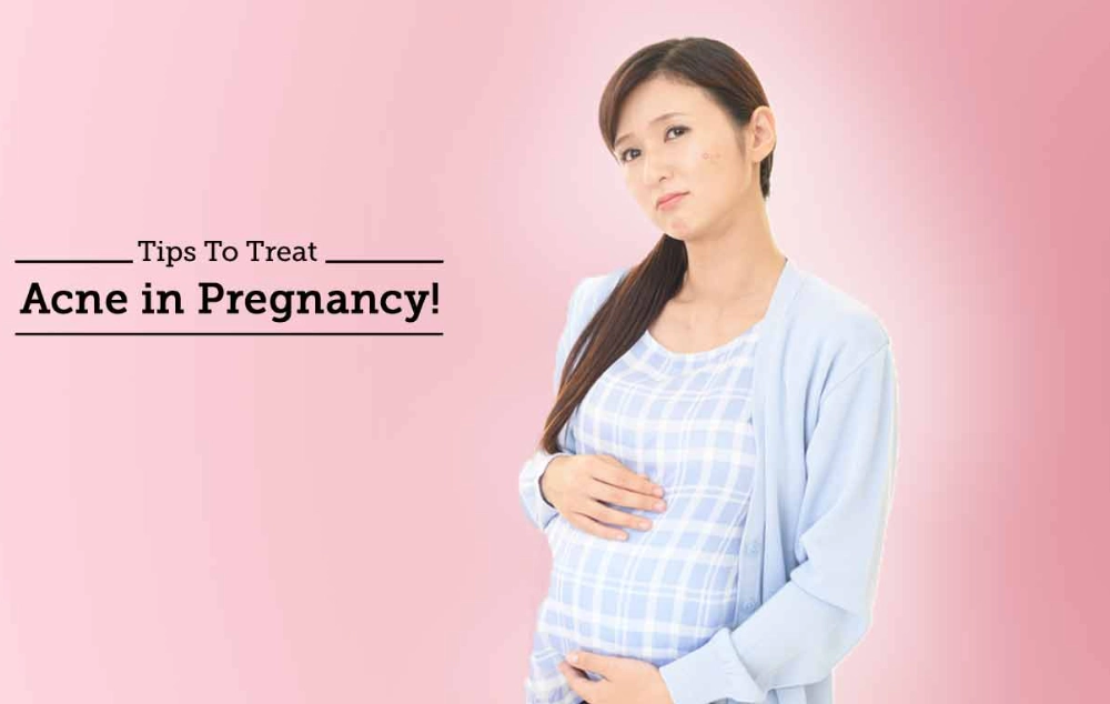 safe acne treatment pregnancy safe acne treatment pregnancy