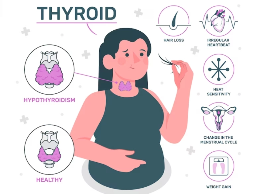 hypothyroidism treatment