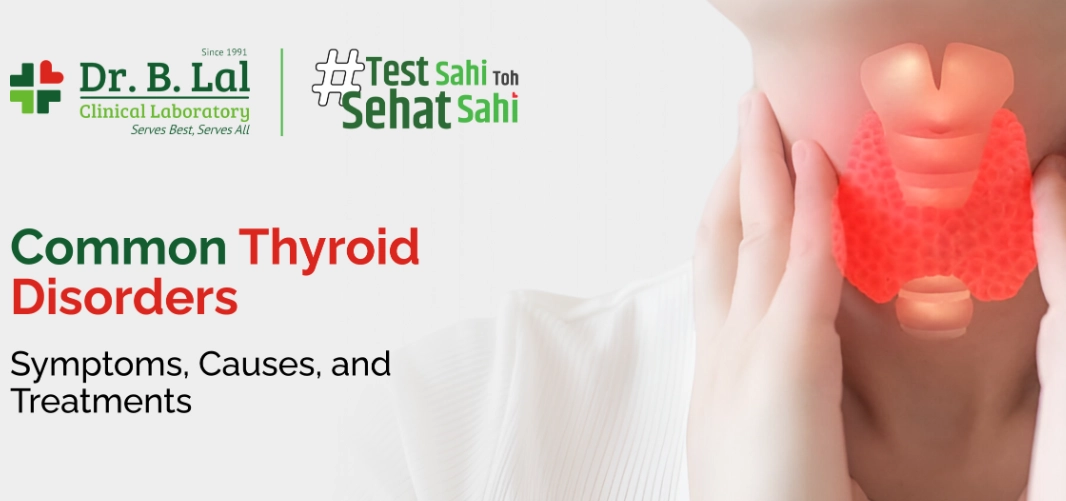 hypothyroidism treatment