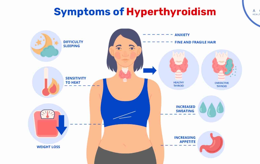 thyroid symptoms in women