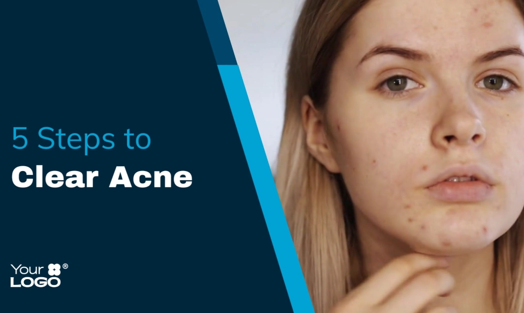 acne treatment routine acne treatment routine
