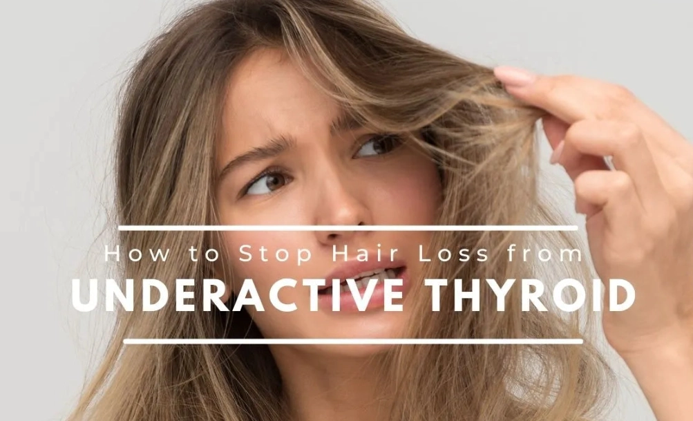 hair loss due to thyroid