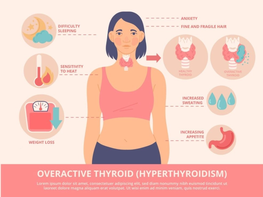 Thyroid symptoms in female treatment
