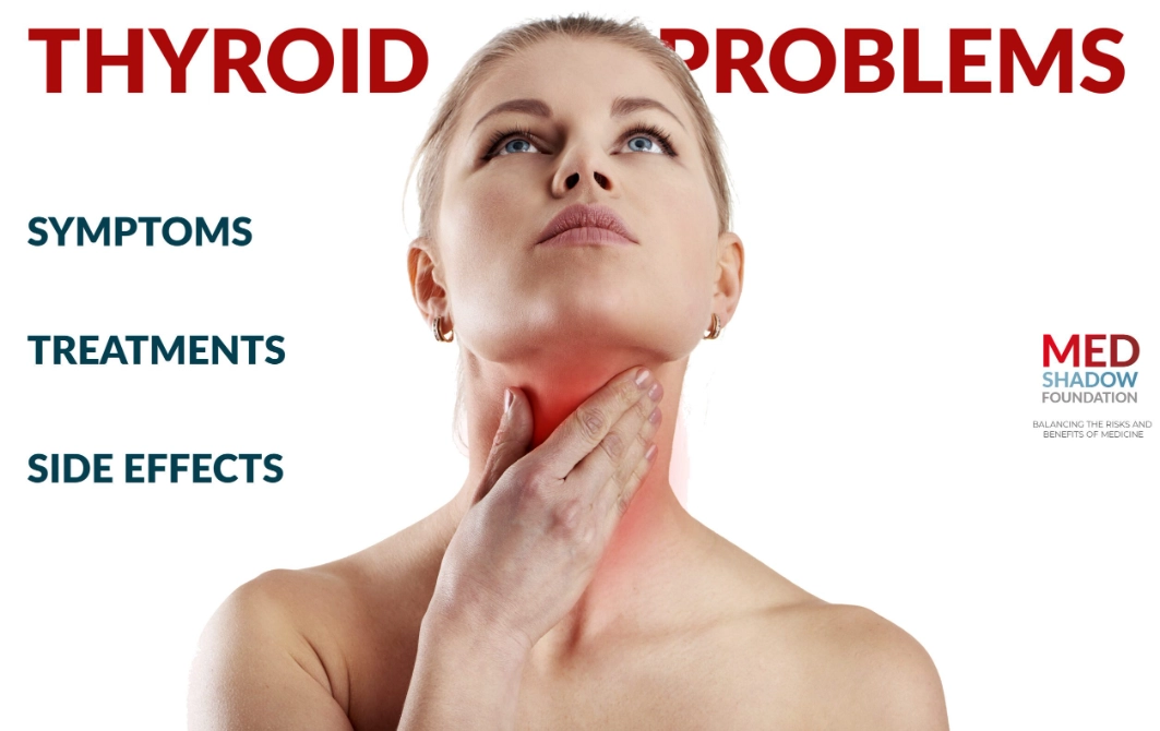 hyperthyroidism in females