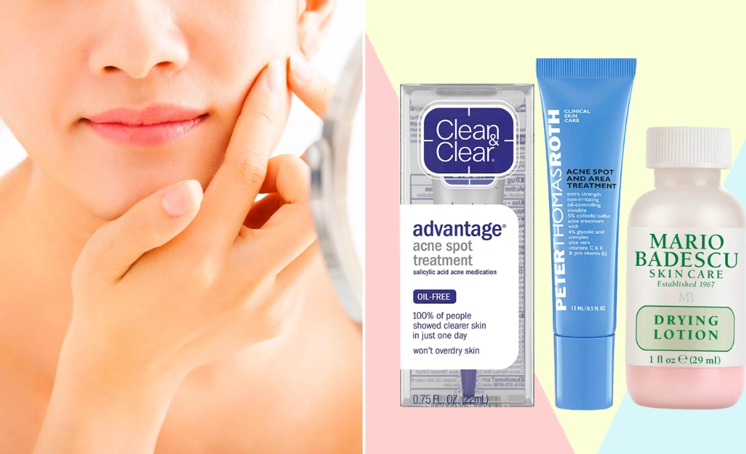 hormonal acne treatment hormonal acne treatment