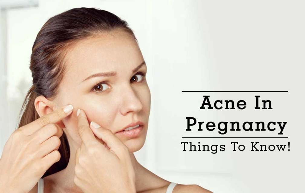 hormonal acne pregnancy hormonal acne pregnancy