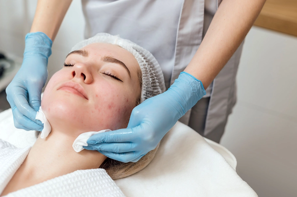 best acne treatment best acne treatment