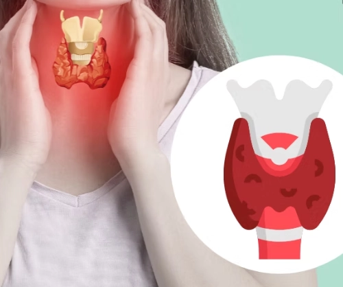 hypothyroidism symptoms female hypothyroidism symptoms female