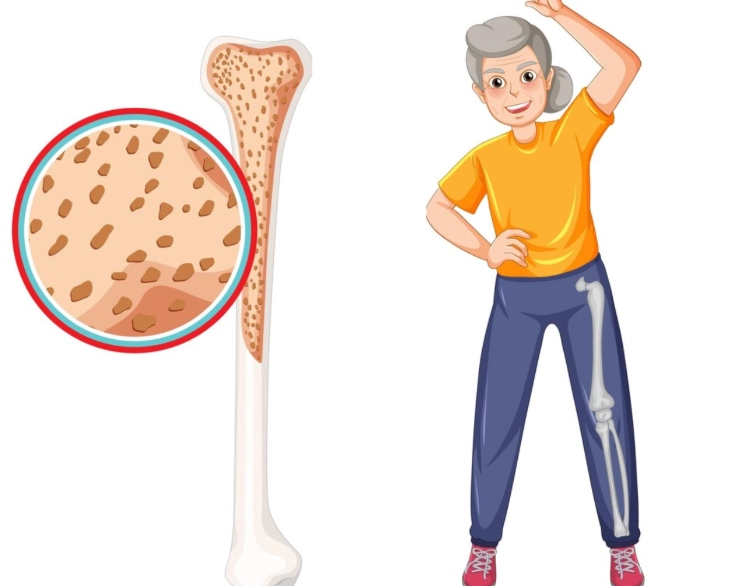 Women's Bone Health: Actionable Steps to Build Stronger Bones